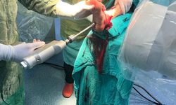 Özel Siirt Hayat Hastanesi’nde 77 Yaşındaki Engelli Hastaya Umut Olan Ameliyat