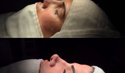 Özel Siirt Hayat Hastanesi’nde Estetik ve Sağlıklı Nefes Bir Arada
