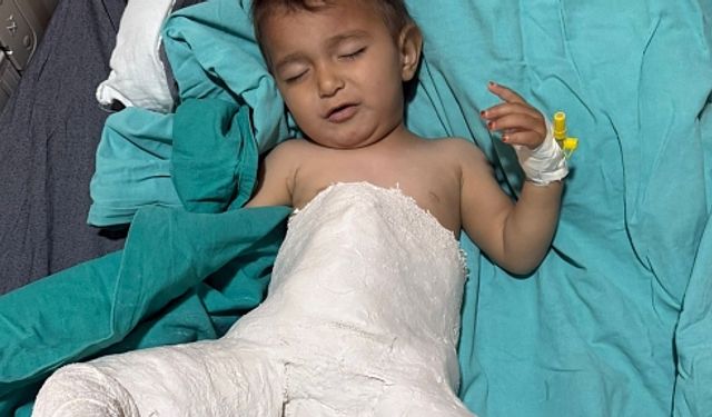 Minik Bebek, Başarılı Kalça Çıkığı Ameliyatı ile Sağlığına Kavuştu